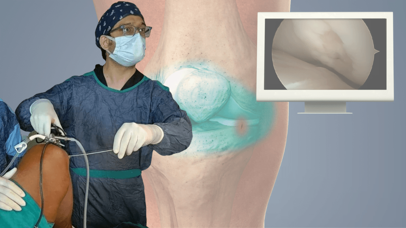 Dr Nikhil Gadre - Arthroscopy in Solapur