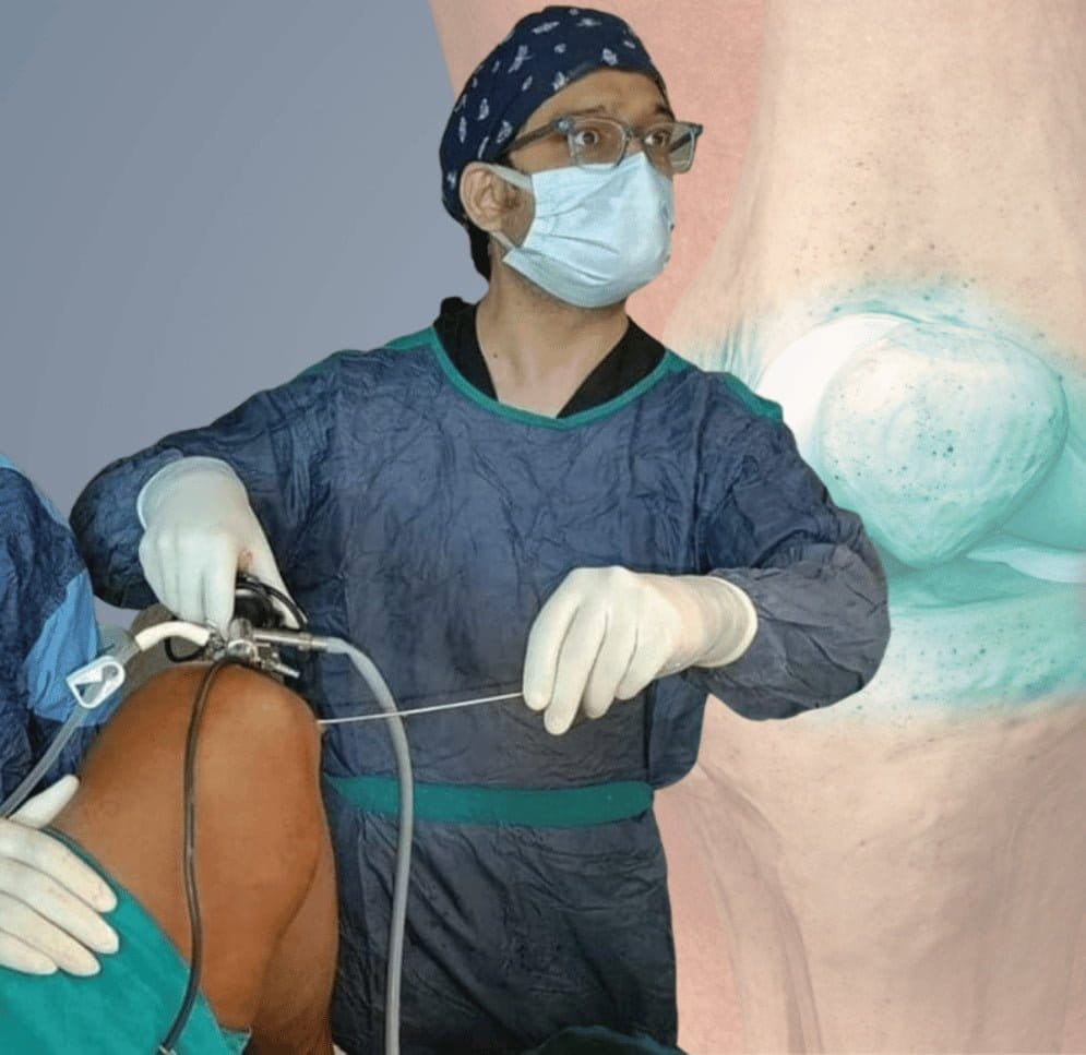 Best Knee Arthroscopy in Solapur