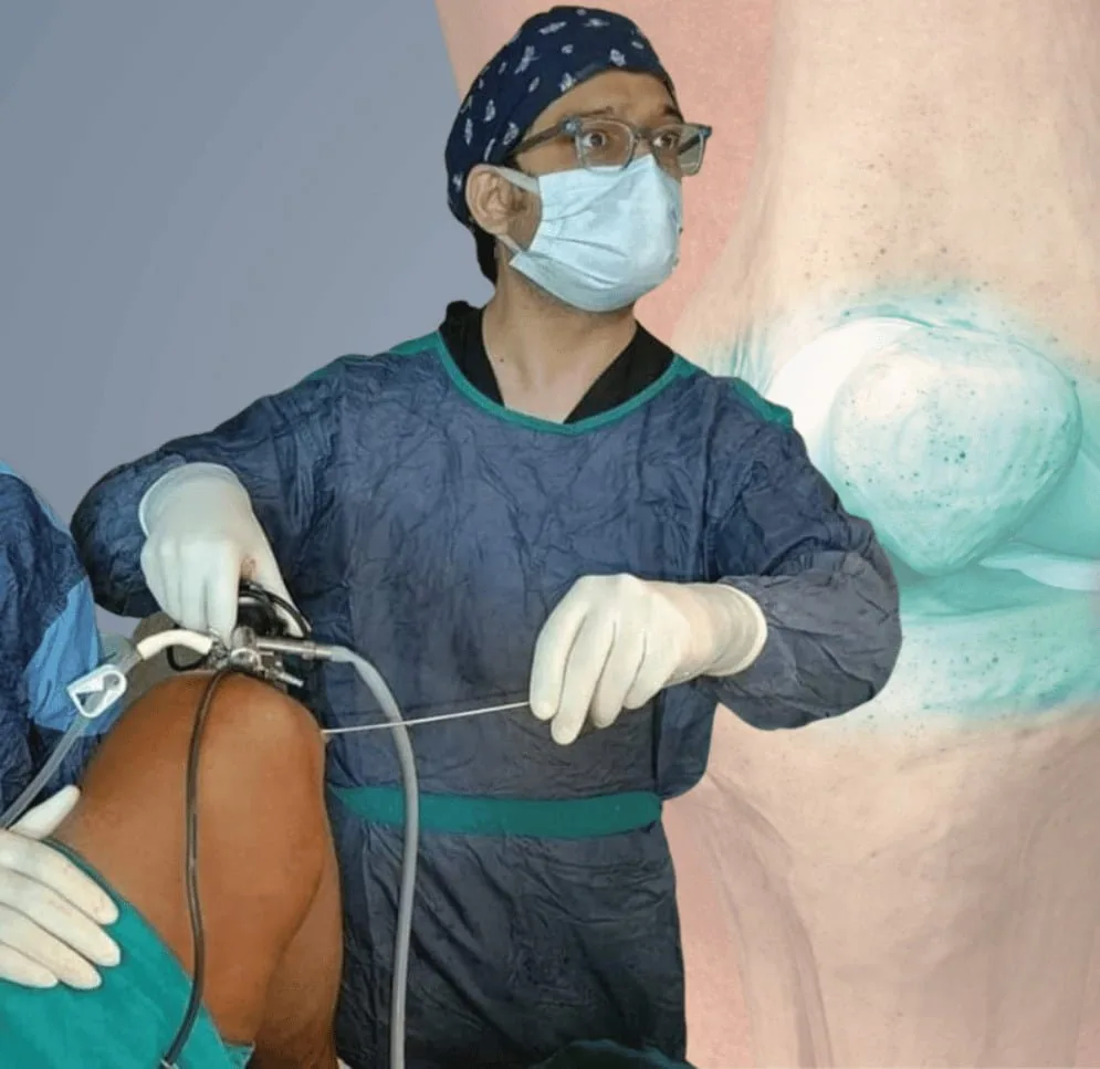 Best Knee Arthroscopy in Solapur