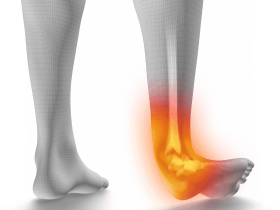 Ankle Deformity Treatment in Solapur