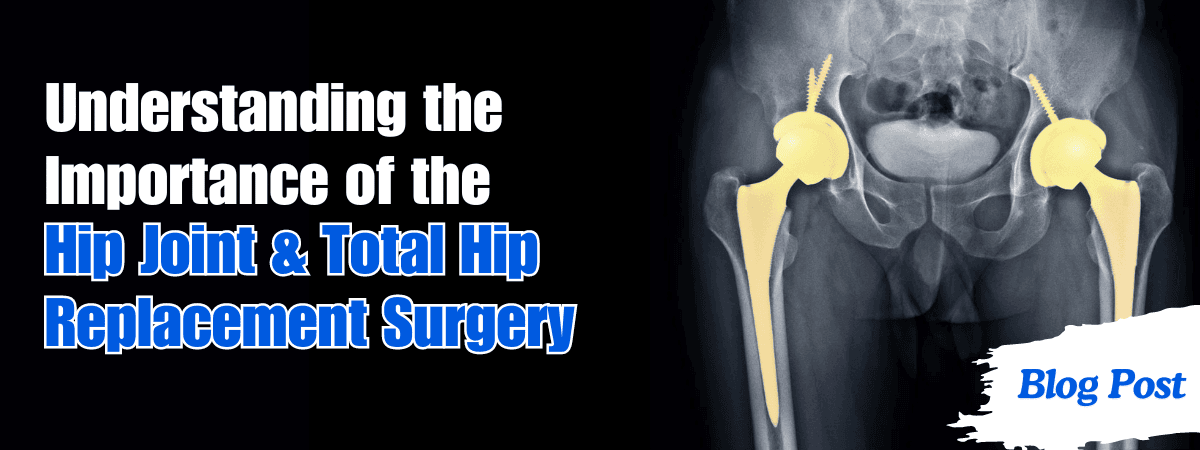 Hip Joint & Total Hip Replacement Surgery