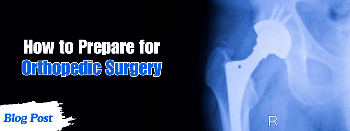 How to Prepare for Orthopedic Surgery