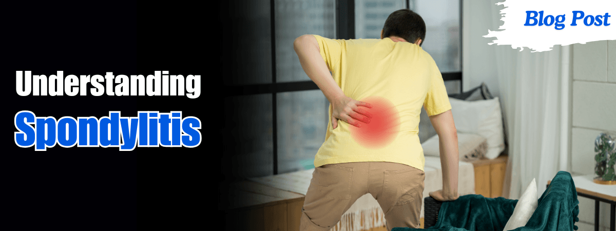 Unerstanding Spondylitis