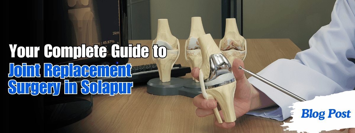Your Complete Guide to Joint Replacement Surgery in Solapur 1 Joint Replacement Surgery in Solapur