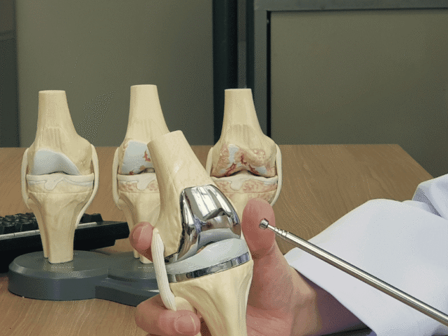 Knee Replacement Surgeon in Solapur