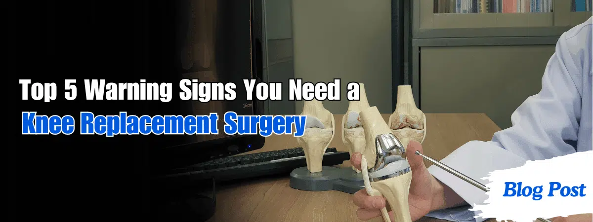 Top 5 Warning Signs You Need a Knee Replacement Surgery in Solapur
