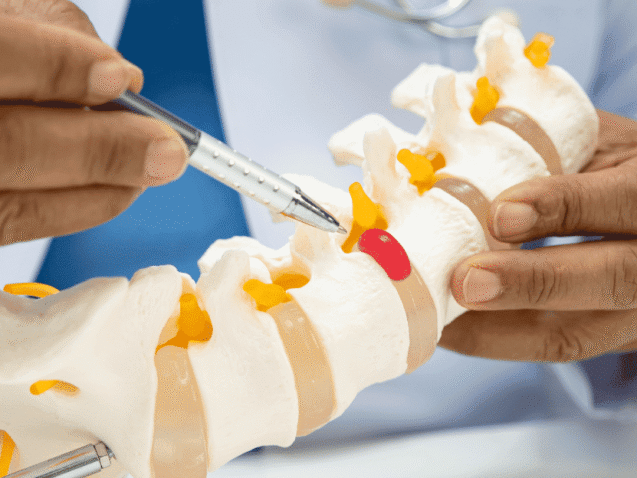Slip Disc Doctor in Solapur