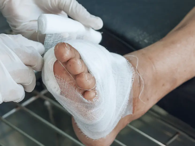Diabetic Foot Treatment in Solapur