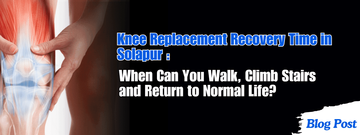 Knee Replacement Recovery Time in Solapur: When Can You Walk, Climb Stairs and Return to Normal Life? 1 Knee Replacement Recovery Time in Solapur